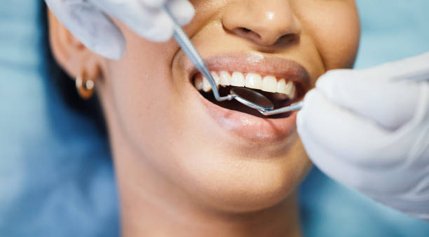 Best Walk-In Emergency Dental Services in Evansville, WI